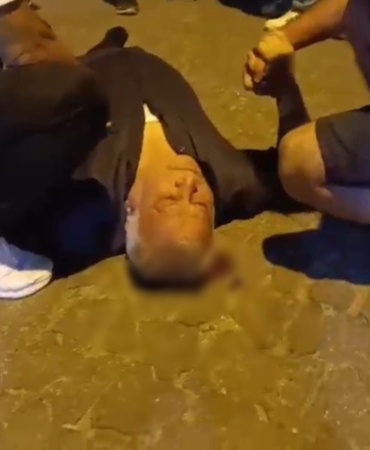 cikan-kavgada-basindan-yaralandi-kanlar-icinde-yerde-kaldi-U1wvmCHl.jpg