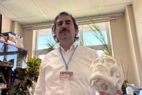 beyin-tumoru-ameliyati-sonrasi-coken-alni-3-boyutlu-implantla-duzeltildi-PaHEKi3g.jpg