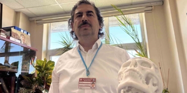 beyin-tumoru-ameliyati-sonrasi-coken-alni-3-boyutlu-implantla-duzeltildi-PaHEKi3g.jpg