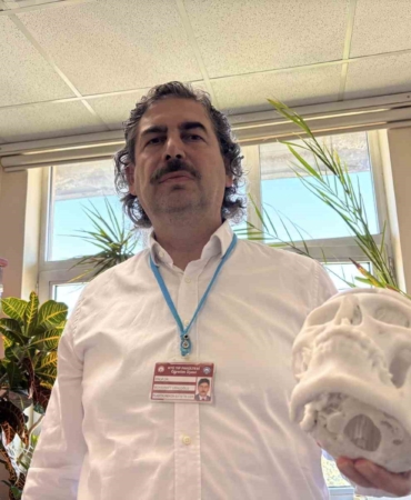 beyin-tumoru-ameliyati-sonrasi-coken-alni-3-boyutlu-implantla-duzeltildi-PaHEKi3g.jpg