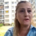 estetik-islem-sonrasi-dudagi-curudu-7-yildir-hukuk-mucadelesi-veriyor-KuTS49ud.jpg