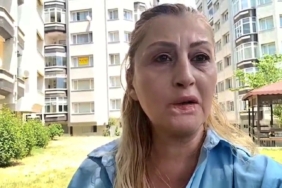 estetik-islem-sonrasi-dudagi-curudu-7-yildir-hukuk-mucadelesi-veriyor-KuTS49ud.jpg