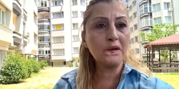 estetik-islem-sonrasi-dudagi-curudu-7-yildir-hukuk-mucadelesi-veriyor-KuTS49ud.jpg