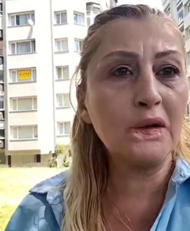 estetik-islem-sonrasi-dudagi-curudu-7-yildir-hukuk-mucadelesi-veriyor-KuTS49ud.jpg