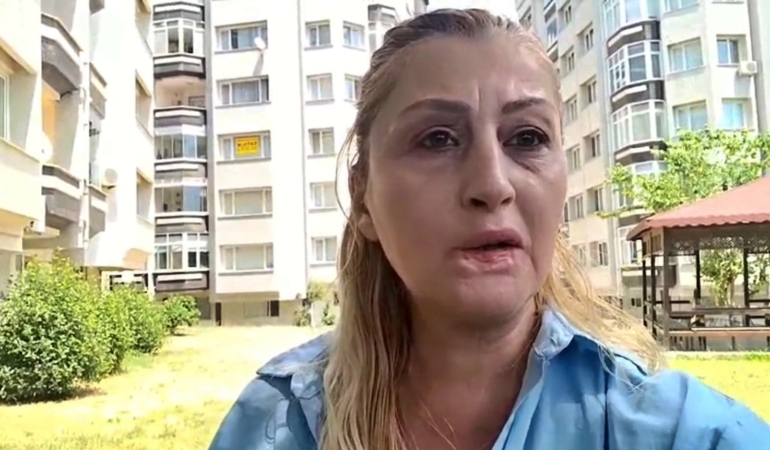 estetik-islem-sonrasi-dudagi-curudu-7-yildir-hukuk-mucadelesi-veriyor-KuTS49ud.jpg
