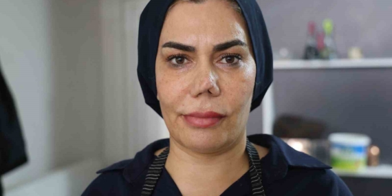Elazığ'da burnu kırılan Aysun Alpsoy, 4 operasyon sonrası mahkemeye gitti