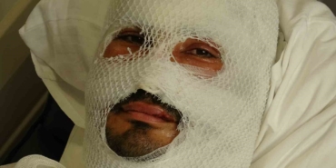Hatay'da yangında ailesini kurtarmaya çalışan adam yaralandı
