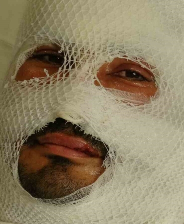 Hatay'da yangında ailesini kurtarmaya çalışan adam yaralandı